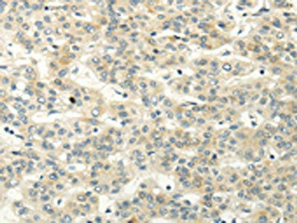 VIPR1 Antibody PACO20855