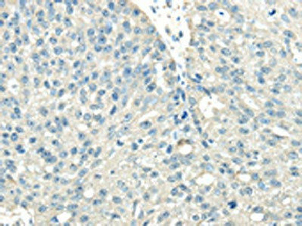 VPS36 Antibody PACO20867