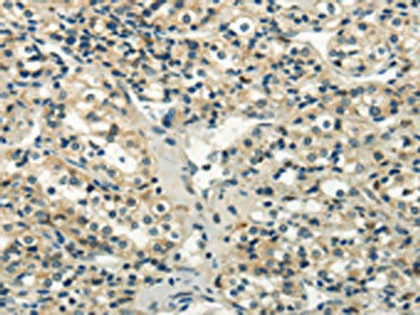 WNK2 Antibody PACO20886