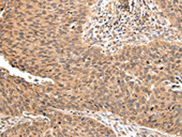 ZNF146 Antibody PACO20960