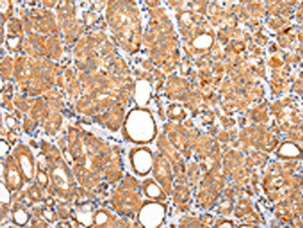 ZNF420 Antibody PACO20964