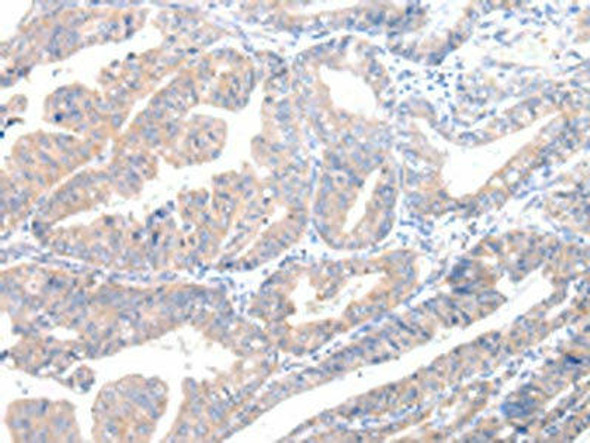 MUC7 Antibody PACO20977