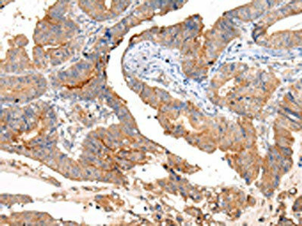 MUC1 Antibody PACO20981