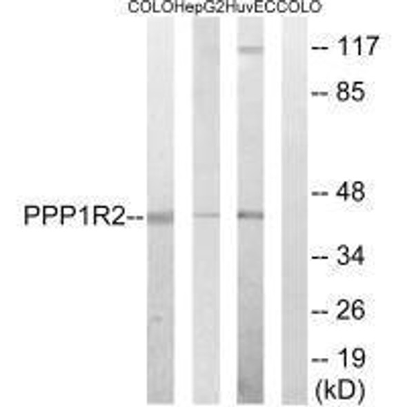 PPP1R2 Ab-44 Antibody PACO21630