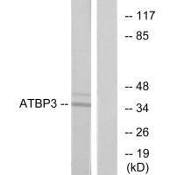 CTU1 Antibody PACO21886