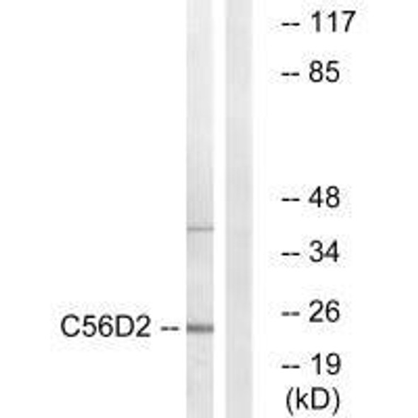 CYB561D2 Antibody PACO22015