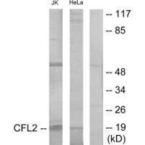CFL1/CFL2 Antibody PACO22037