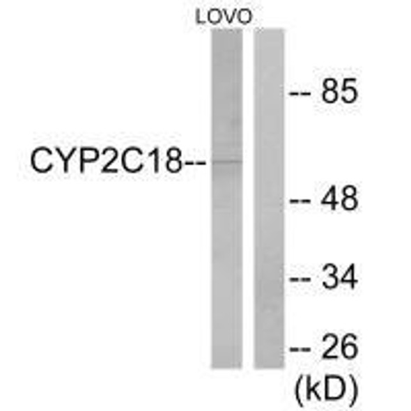 CYP2C18/CYP2C8/CYP2C9/CYP2C19 Antibody PACO22047