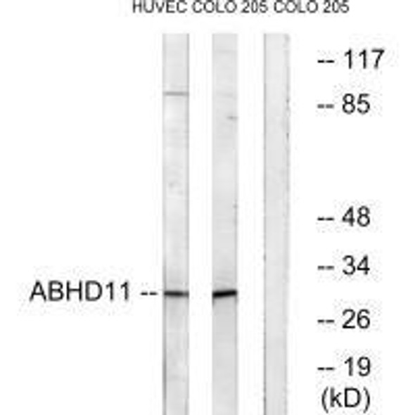 ABHD11 Antibody PACO22109