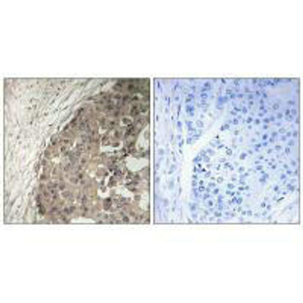 CSGALNACT1 Antibody PACO22266