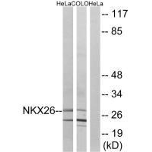 NKX2-6 Antibody PACO22379