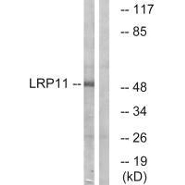 LRP11 Antibody PACO22396