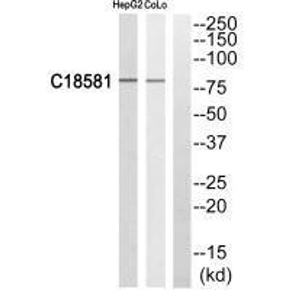 NEK5 Antibody PACO22593