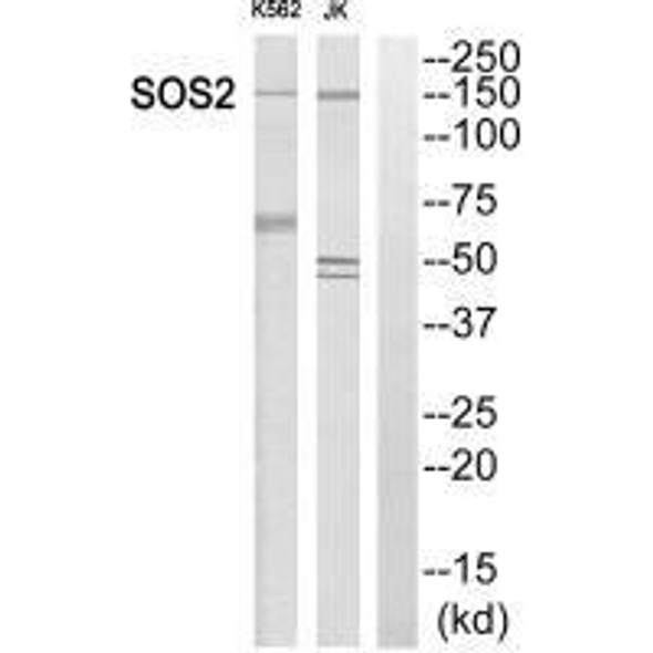 SOS2 Antibody PACO22628