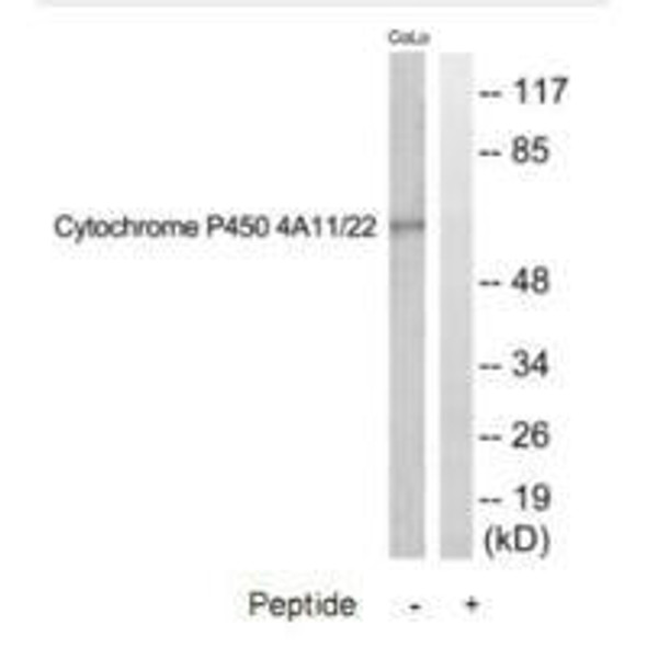 CYP4A11/CYP4A22 Antibody PACO22779