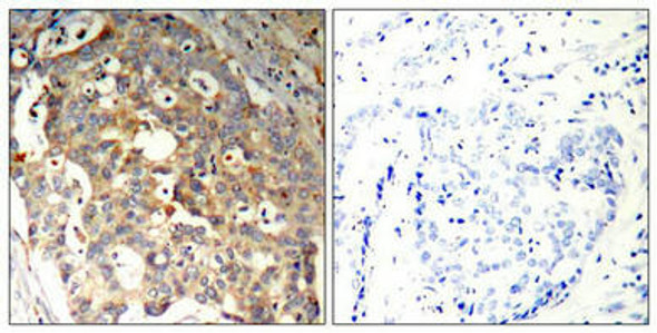 MAPK9/MAPK10 Ab-183 Antibody PACO22959