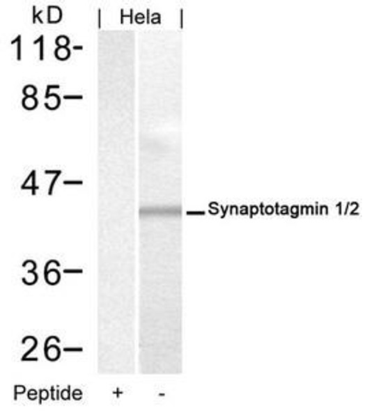 SYT1/SYT2 Ab-202/199 Antibody PACO22975