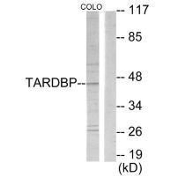 TBX1 Antibody PACO23168