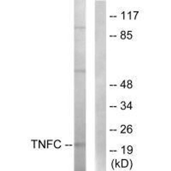 LTB Antibody PACO23242