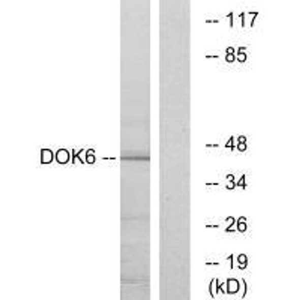 DOK6 Antibody PACO23256