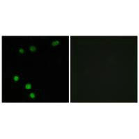 TP53INP2 Antibody PACO23263