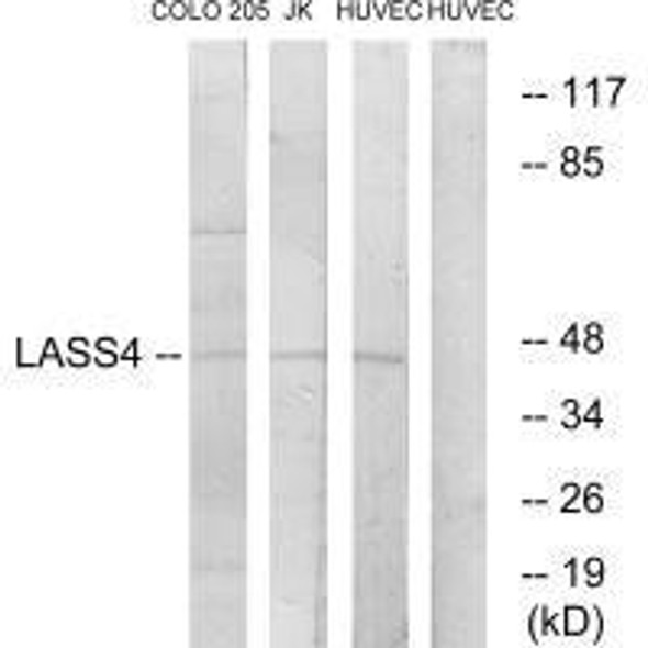 CERS4 Antibody PACO23283