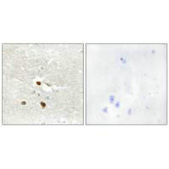 ZNF287 Antibody PACO23284