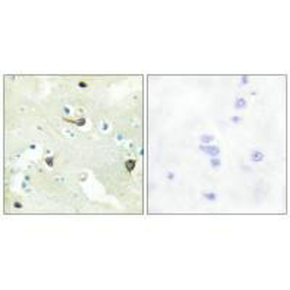 EPHB1/EPHB2/EPHB3 Antibody PACO23432