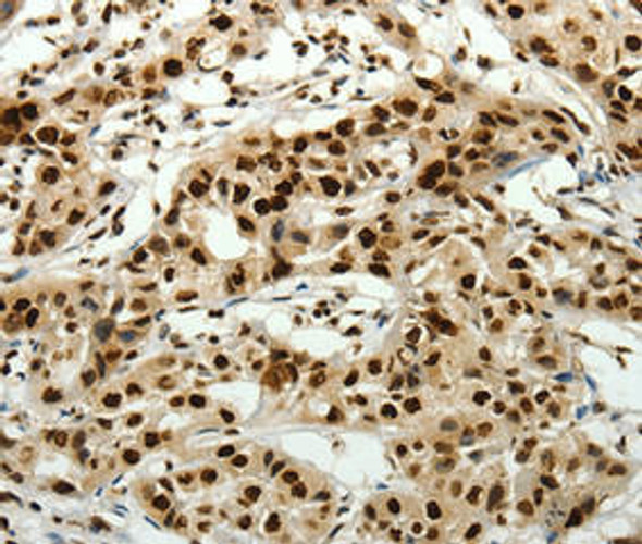 SCN11A Antibody PACO23524