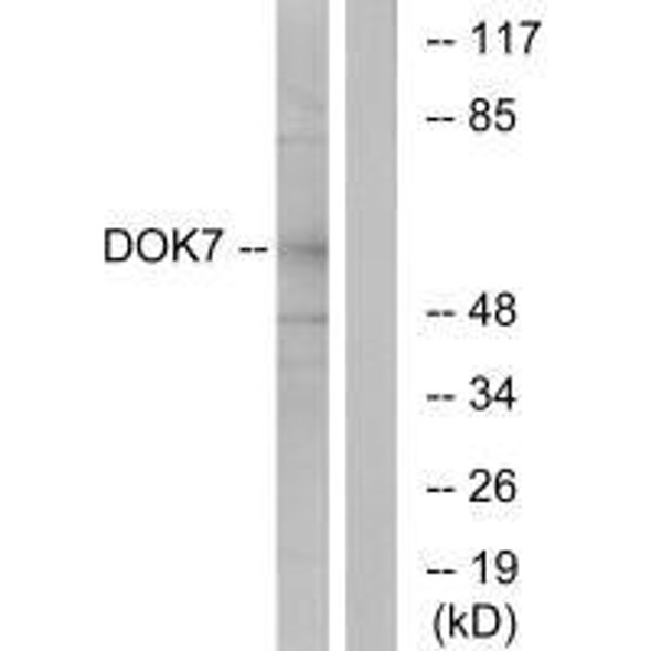 DOK7 Antibody PACO23751