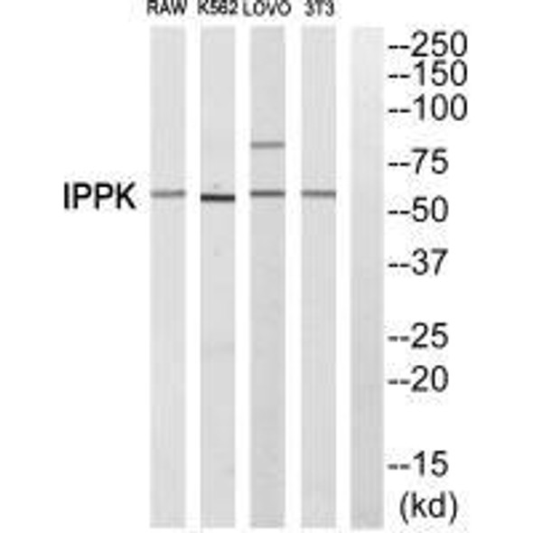 IPPK Antibody PACO23768