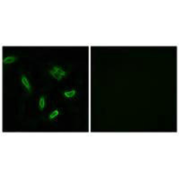 SLC27A5 Antibody PACO23797