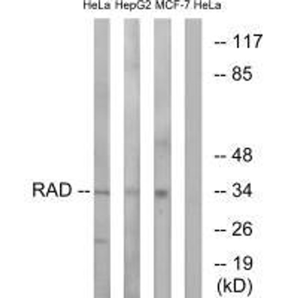 RRAD Antibody PACO23803