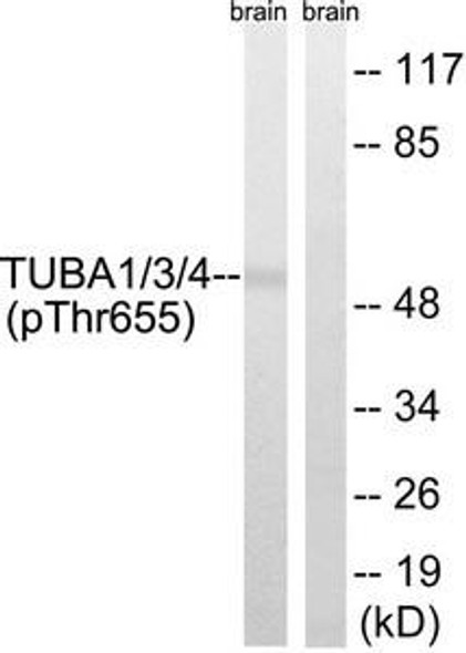 Phospho-TUBA1A/TUBA1B/TUBA1C/TUBA3C/TUBA3E/TUBA4A Tyr272 Antibody PACO24172