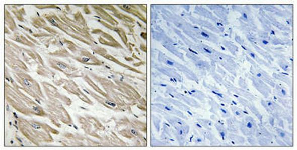 Phospho-PPP1R2 Ser120/Ser121 Antibody PACO24212