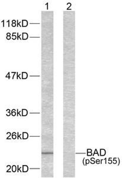 Phospho-Bad Ser155 Antibody PACO24359