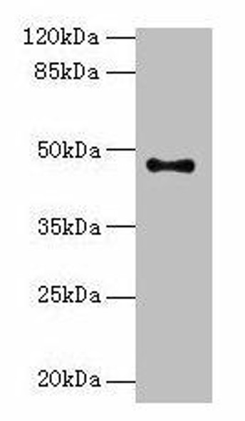 AADACL2 Antibody PACO24676
