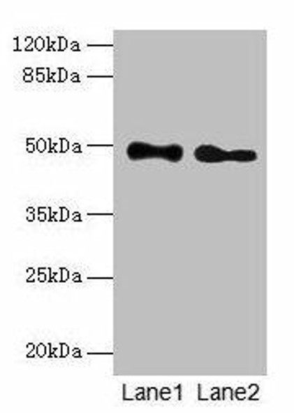 ABHD2 Antibody PACO24688