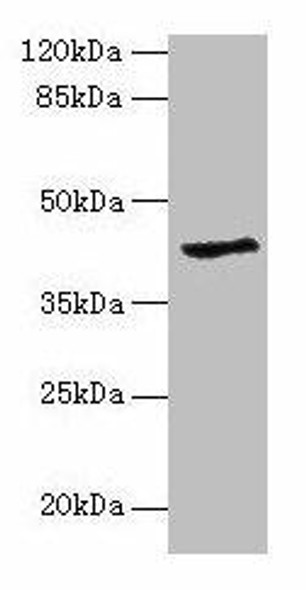 GDAP1L1 Antibody PACO26933