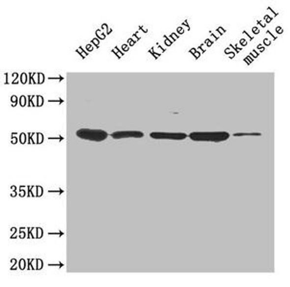 Igfbp1 Antibody PACO27553