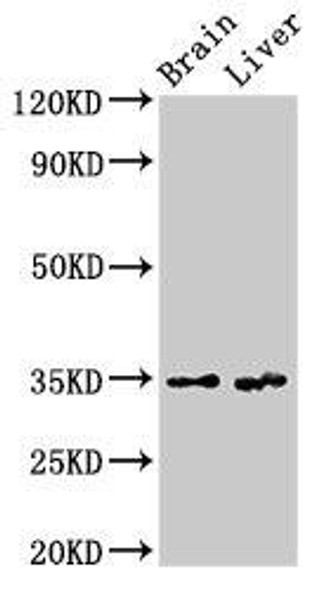 RBKS Antibody PACO29388