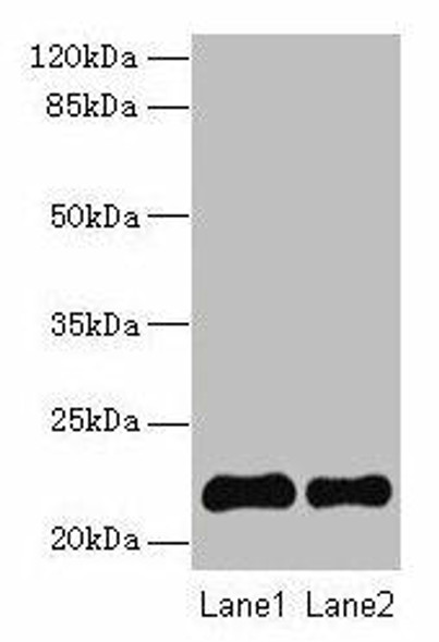 SIRPD Antibody PACO29904