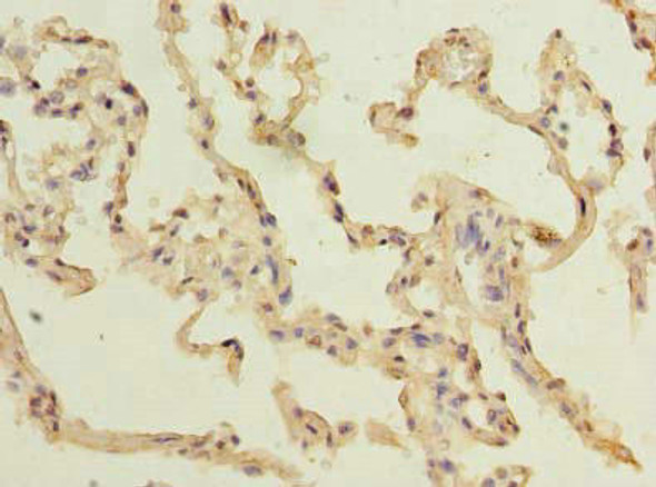 TM4SF1 Antibody PACO30434