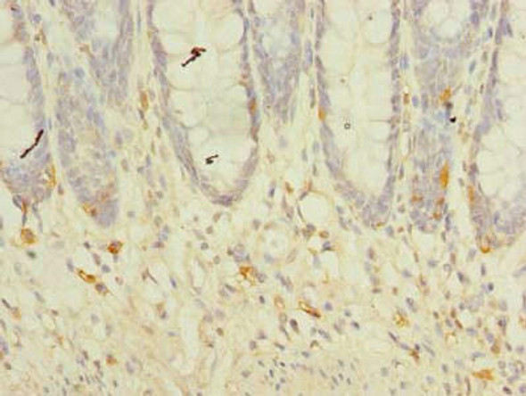 TMEM41A Antibody PACO30594