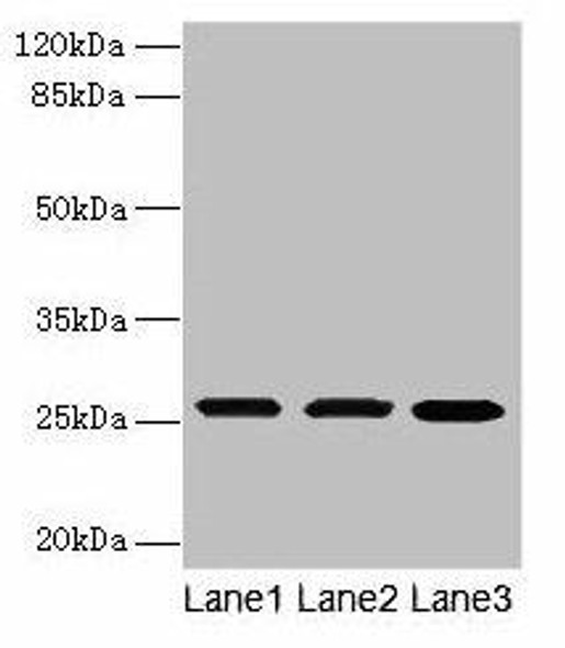 TMEM65 Antibody PACO30638