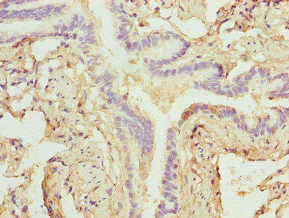 ZNF212 Antibody PACO31200