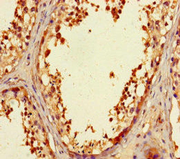 ZNF230 Antibody PACO31224