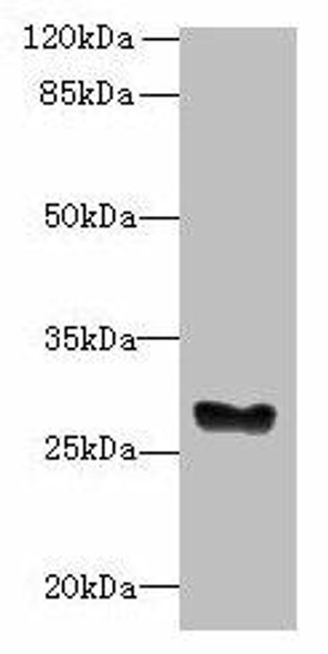 GPM6B Antibody PACO35366