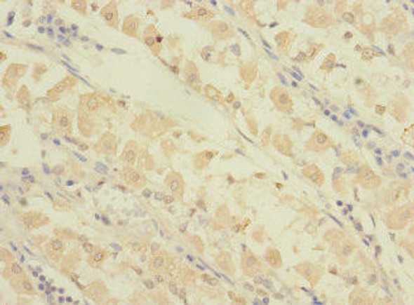 GRAMD1B Antibody PACO35950