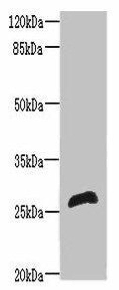 RTP2 Antibody PACO36530